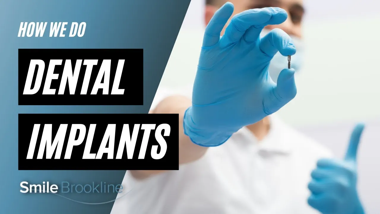 Video: Dental Implants Procedure
