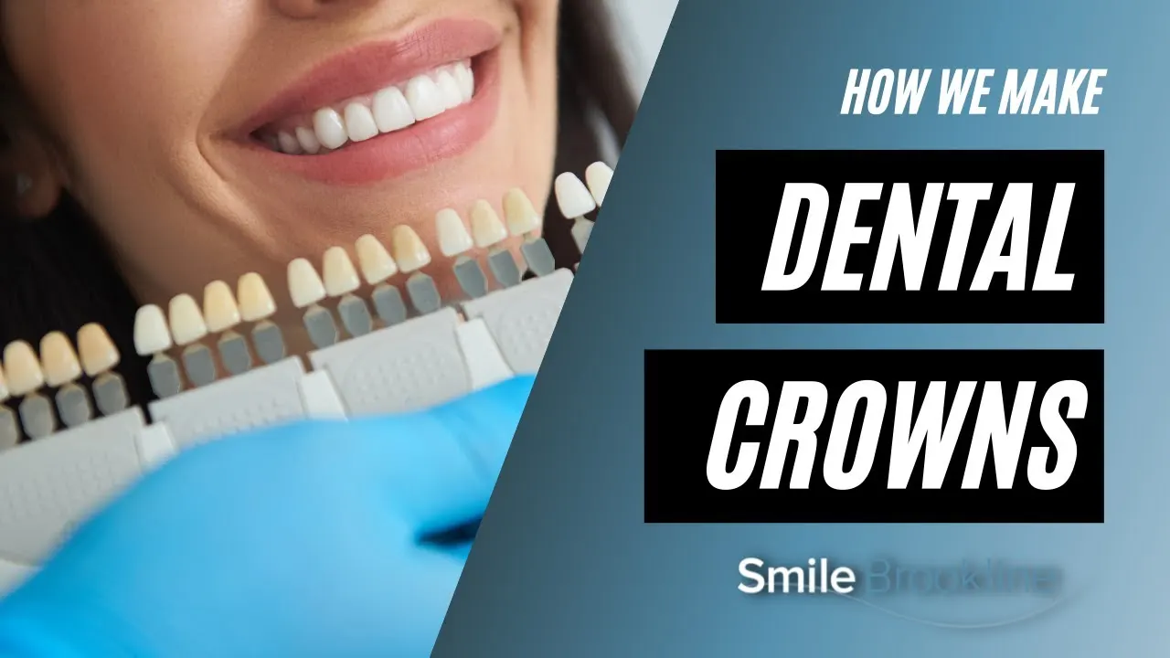 Video: Dental Crowns Explained