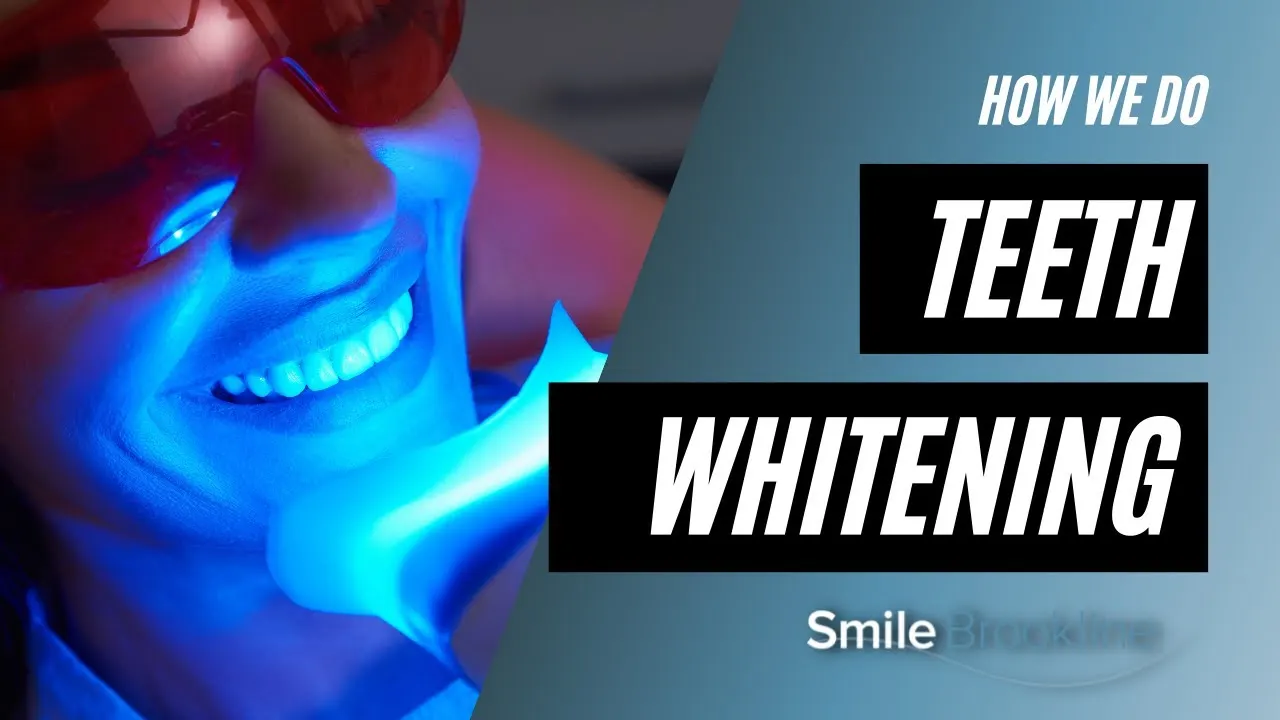 Video: Teeth Whitening at the Dentist